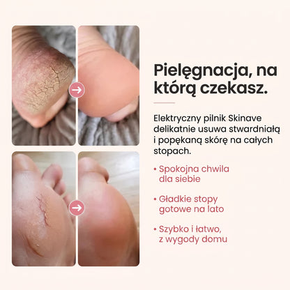 Skinave™ - Elektryczny pilnik do stóp