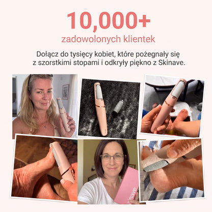 Skinave™ - Elektryczny pilnik do stóp